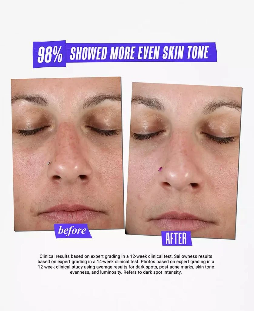 Kiehl's Dermatologist Solutions Clearly Corrective Dark Spot Solution, 3.8 oz. 8