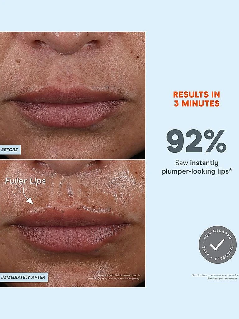 NuFace FIX MicroWand 4