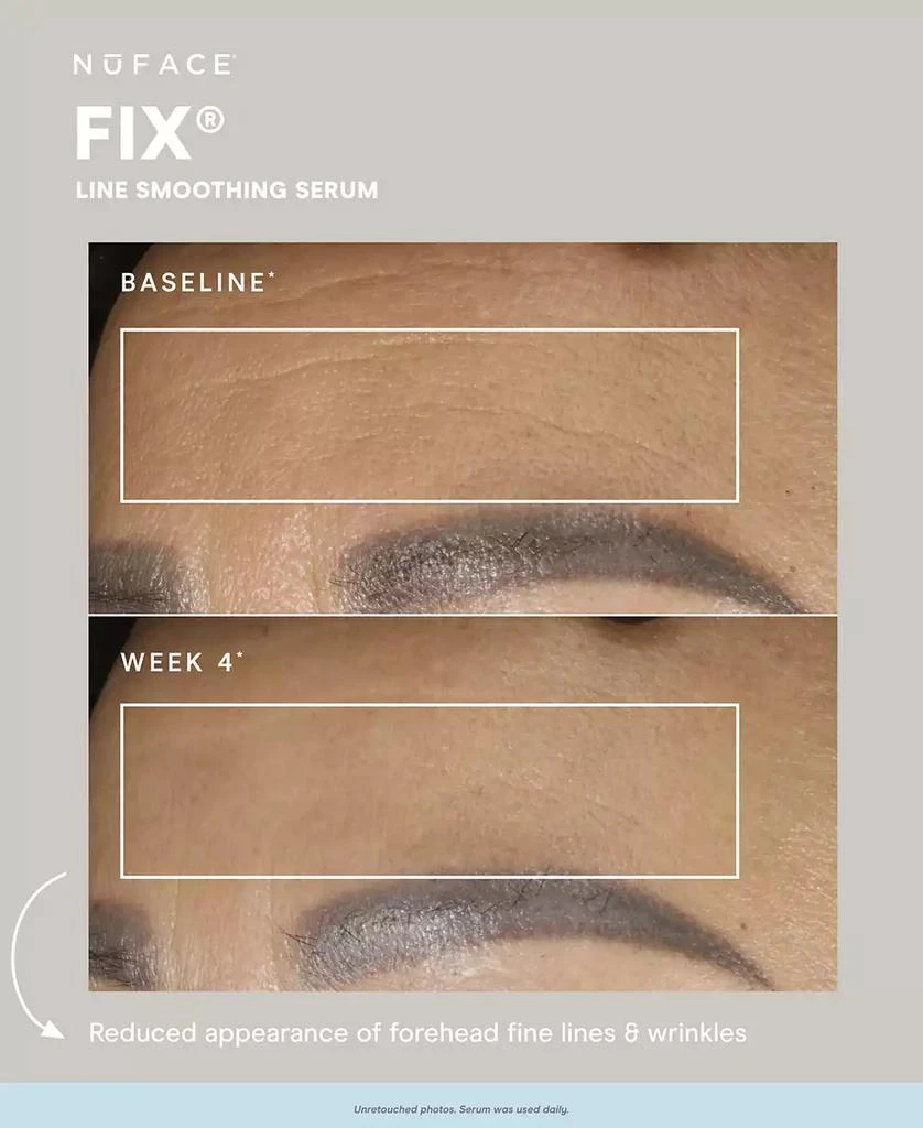 NuFace FIX® Serum, .5 oz. 2