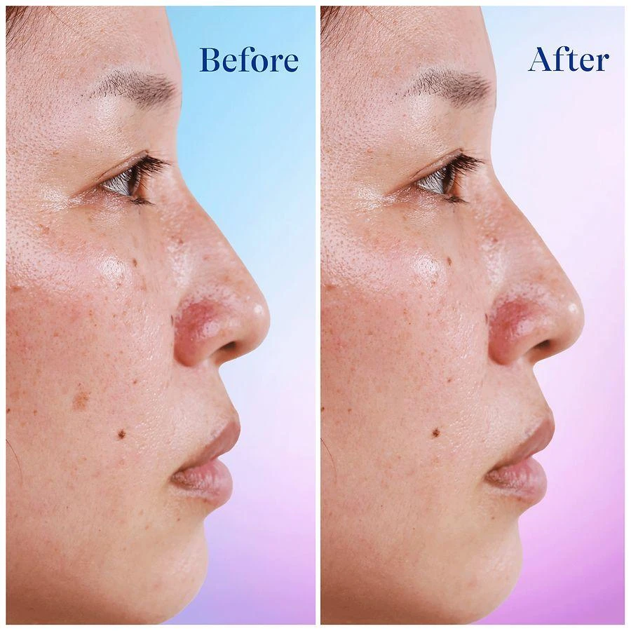 Differin Dark Spot Correcting Serum 6