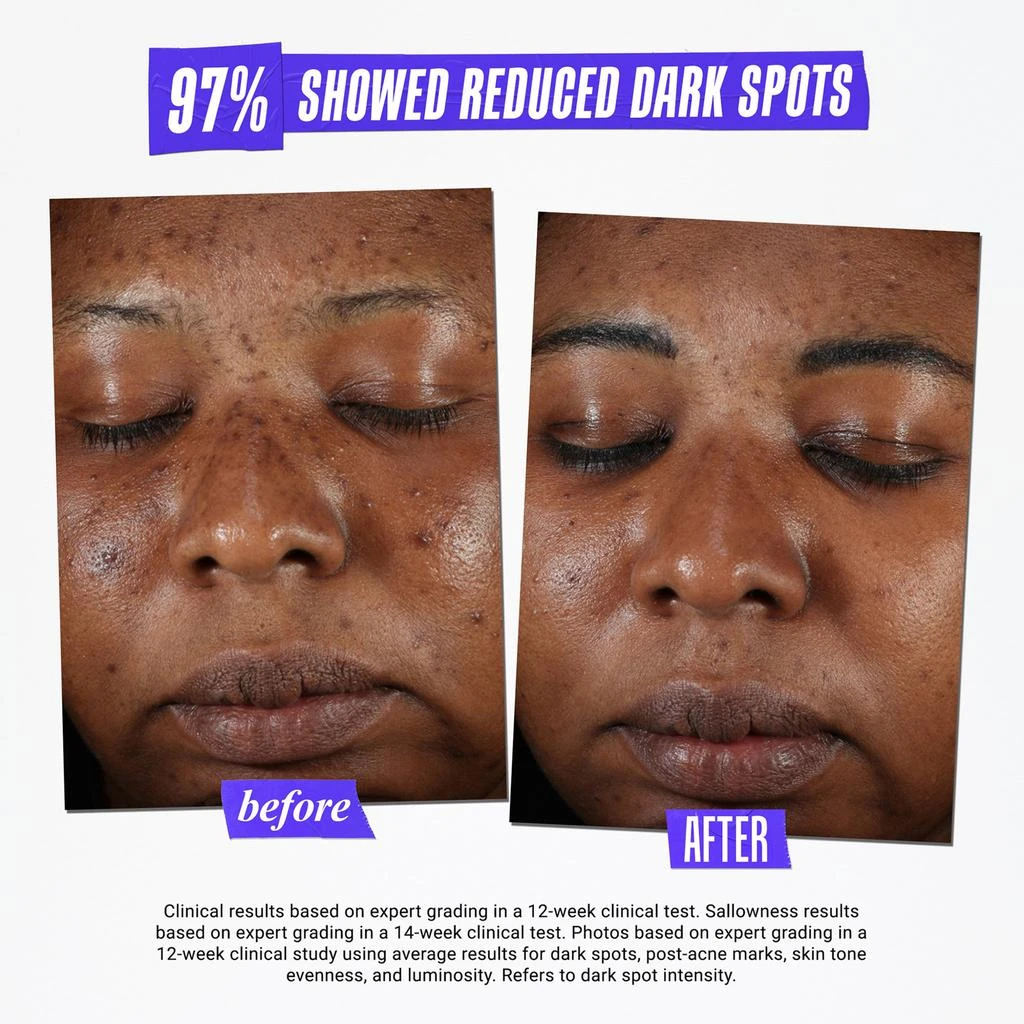 Kiehl's Since 1851 Clearly Corrective Dark Spot Solution 6