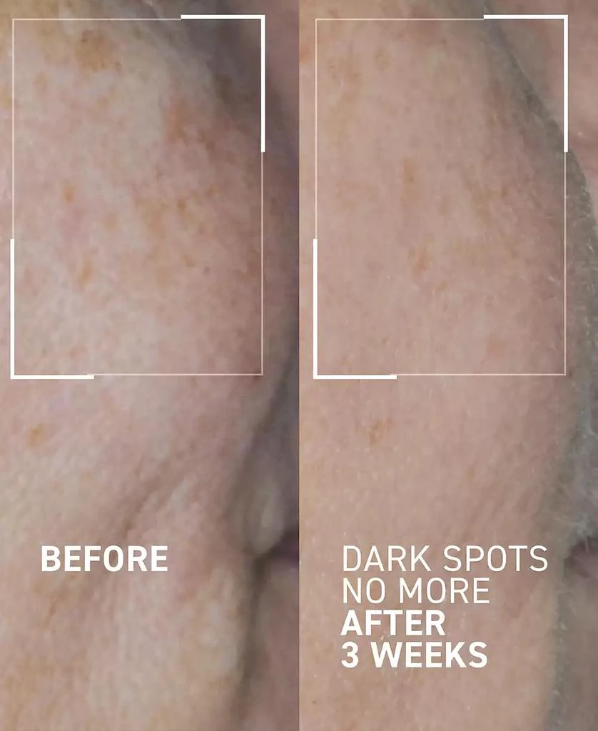 Dr. Brandt Skincare Dark Spots No More 2