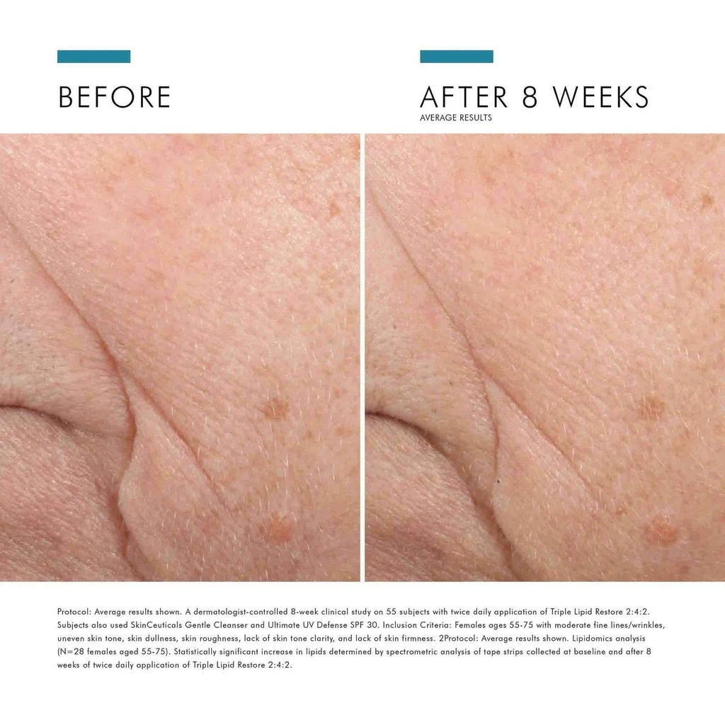SkinCeuticals SkinCeuticals Triple Lipid Restore 2:4:2 6
