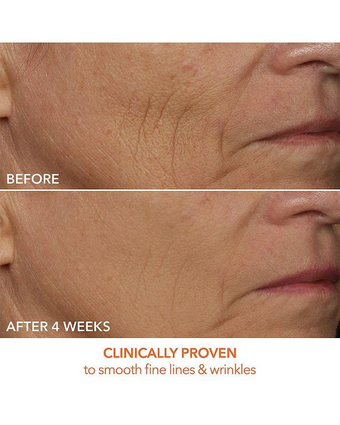 Dr. Dennis Gross DRx SpectraLite™ Faceware Pro 5