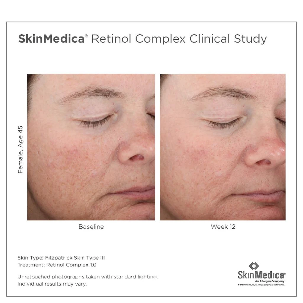 SkinMedica SkinMedica Age Defense Retinol Complex 1.0 4