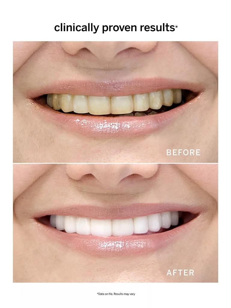 supersmile Extra White System 3