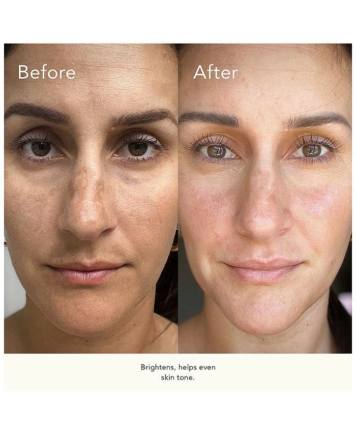 Kat Burki BioCell Correcting Serum 1 oz. 2