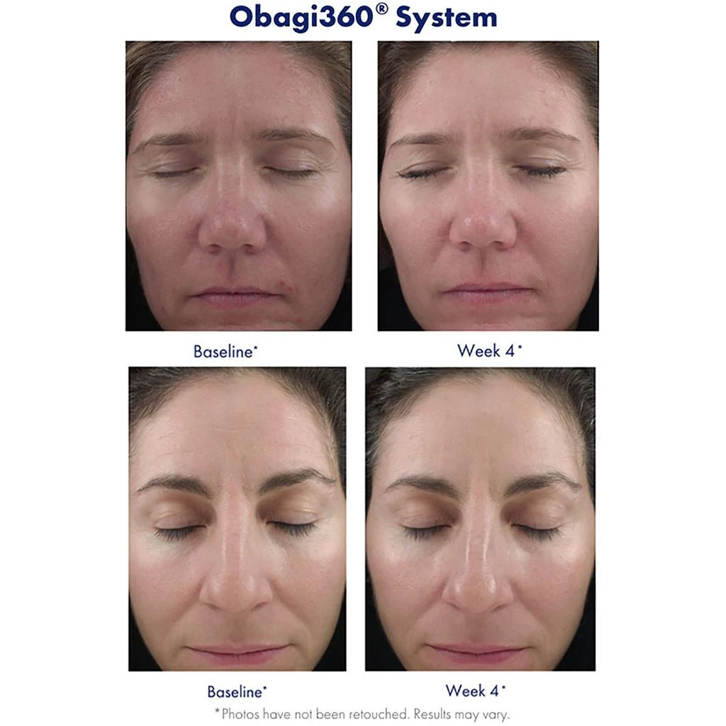 Obagi Medical Obagi Medical Retinol 1.0 3