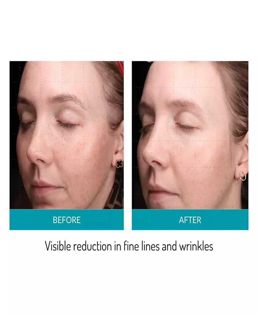 glo Mask LED Phototherapy Mask 8