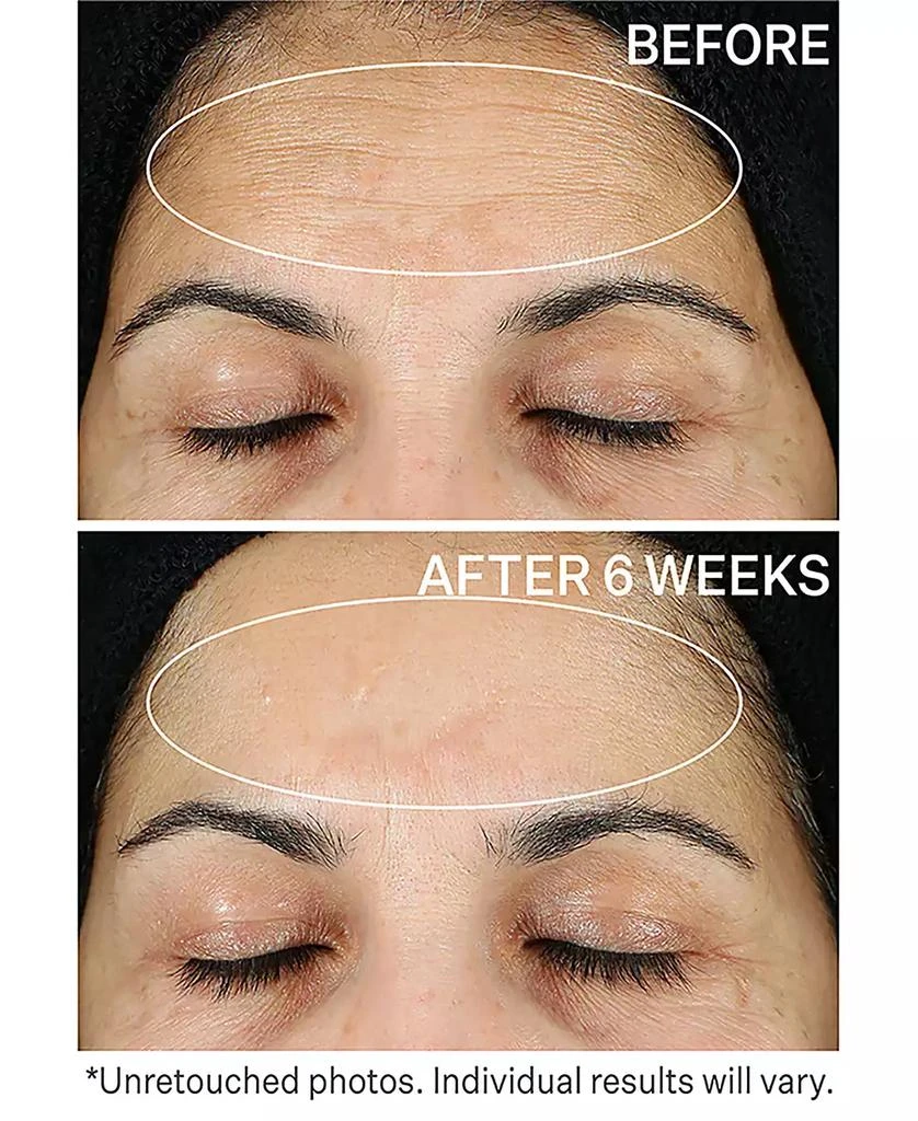 StriVectin Super C Retinol Brighten and Correct Vitamin C Serum, 1oz 3