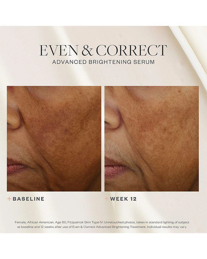 SkinMedica Even & Correct Advanced Brightening Treatment 2 oz. 8