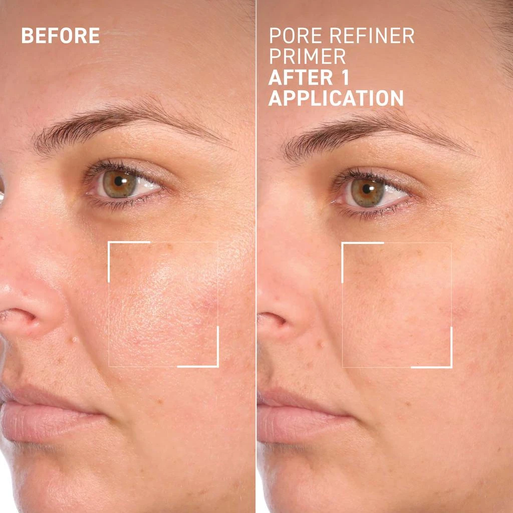 Dr. Brandt Skincare Best in Brandt 5