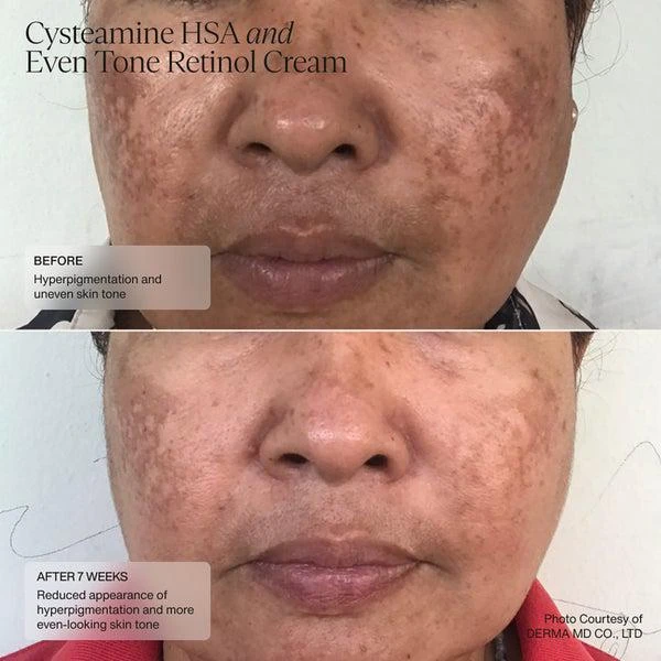 SENTÉ SENTÉ Even Tone Retinol Cream 30ml 6