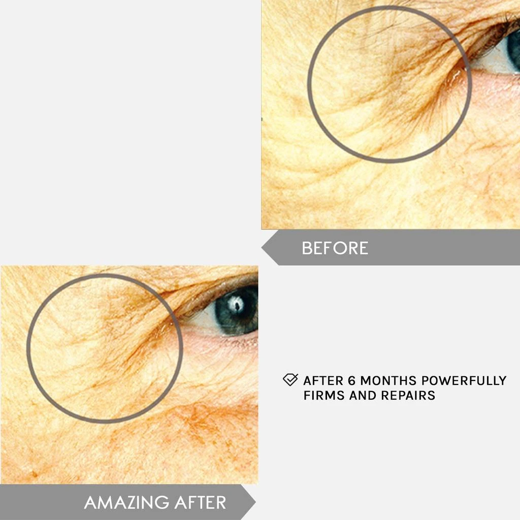 Mirenesse Winner Best Eye Serum - NEW Superstar Eye Serum 4