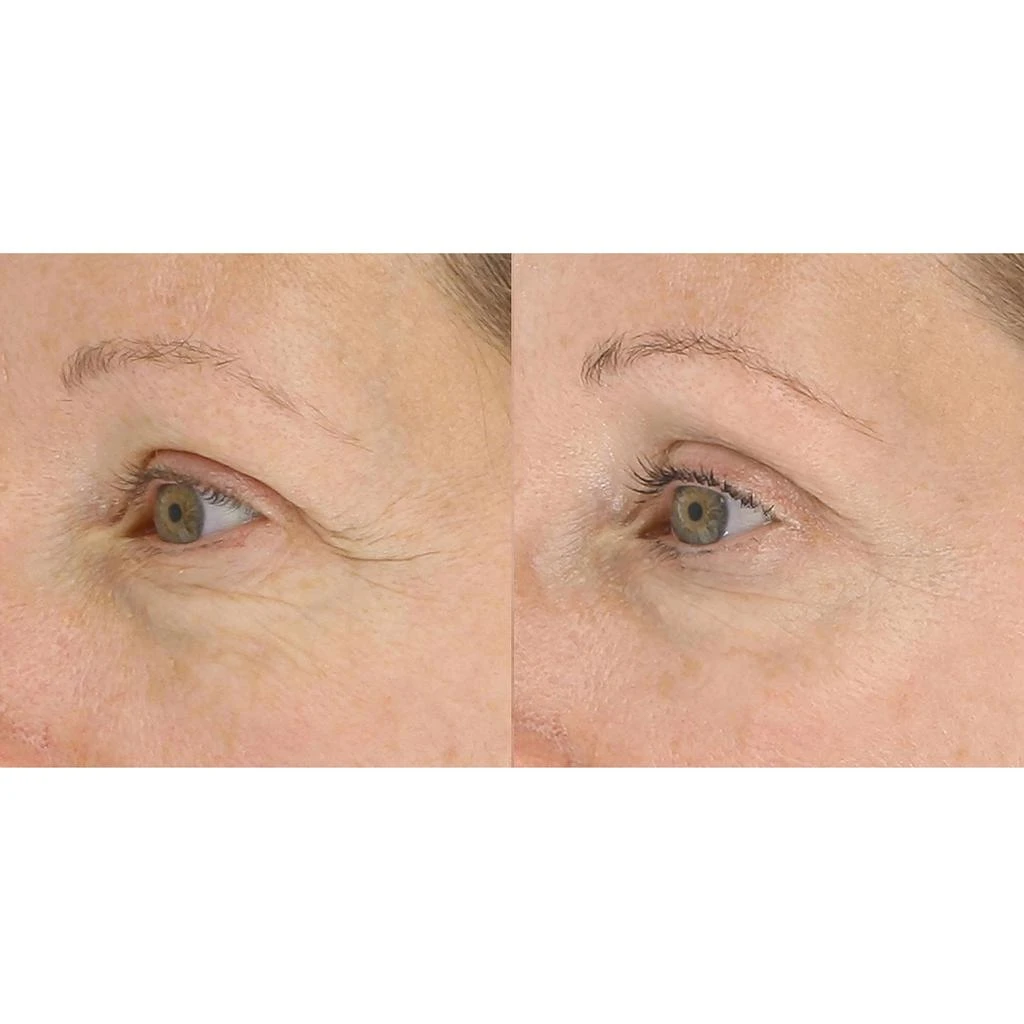 LightStim LightStim for Wrinkles - White 10