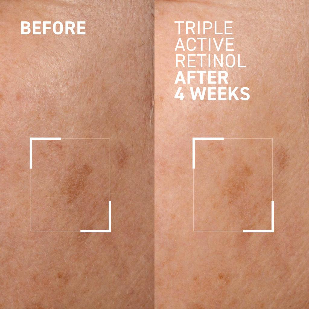 Dr. Brandt Skincare TRIPLE ACTIVE RETINOL