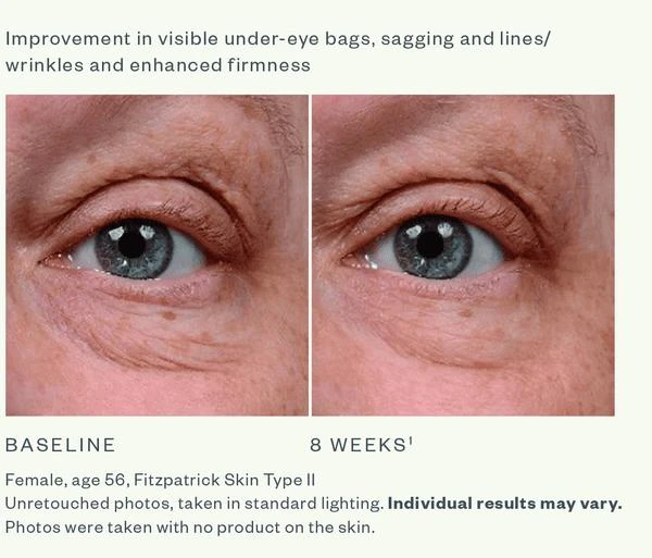 SkinMedica SkinMedica Instant Bright Eye Cream 14.2g 5