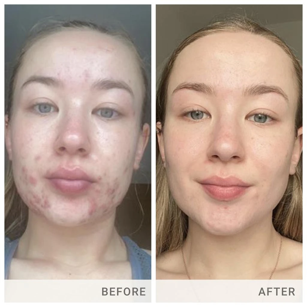 Jane Iredale jane iredale Skin Accumax 14 Week Reset Box 4