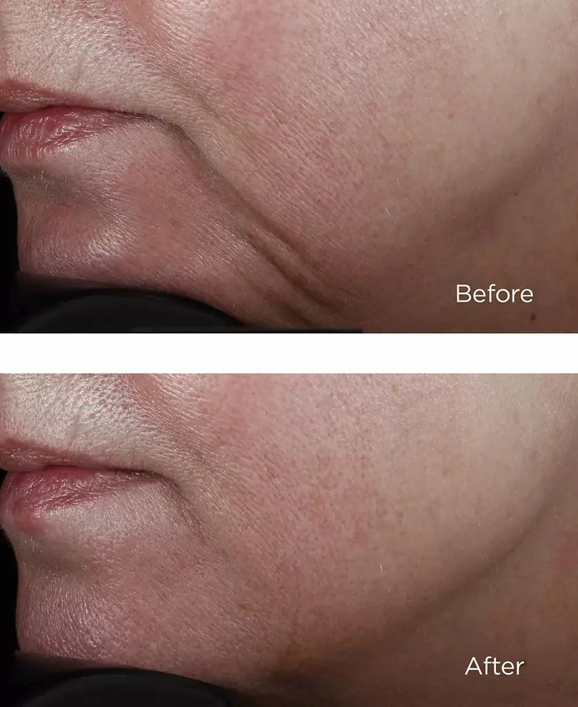 Perricone MD High Potency Classics Face Firming Serum, 2-oz. 2