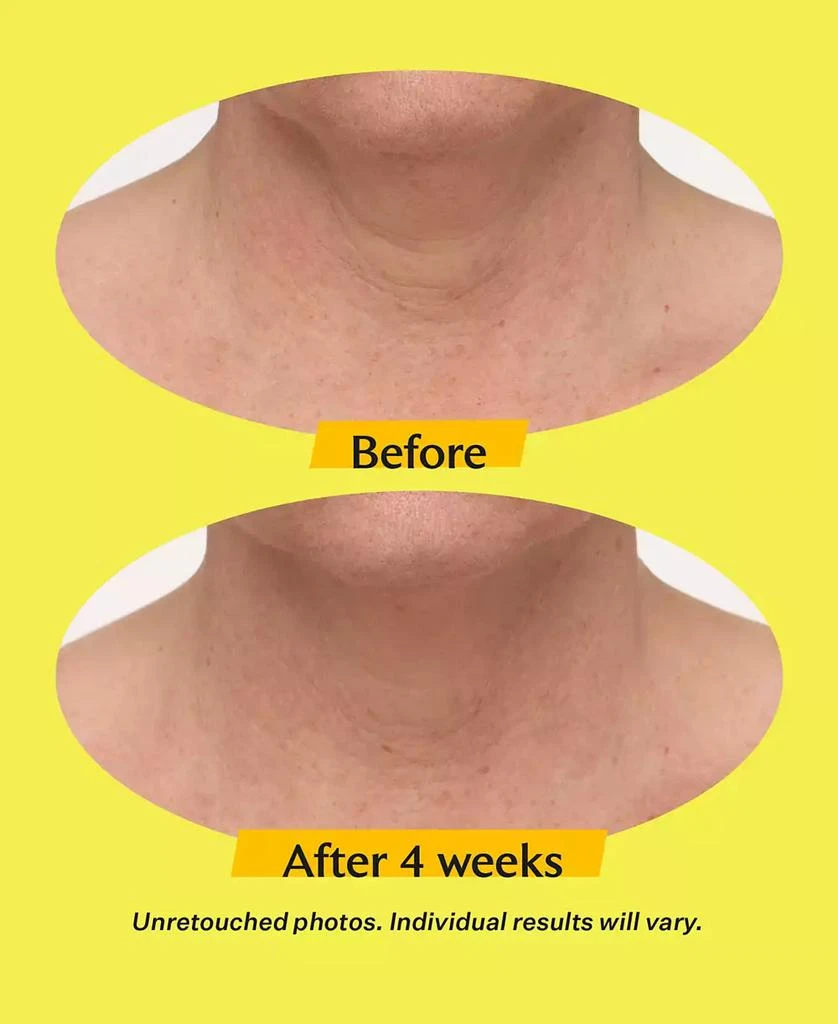 StriVectin TL Advanced Tightening Neck Cream Plus With Alpha-3 Peptide, 3.4 oz. 16