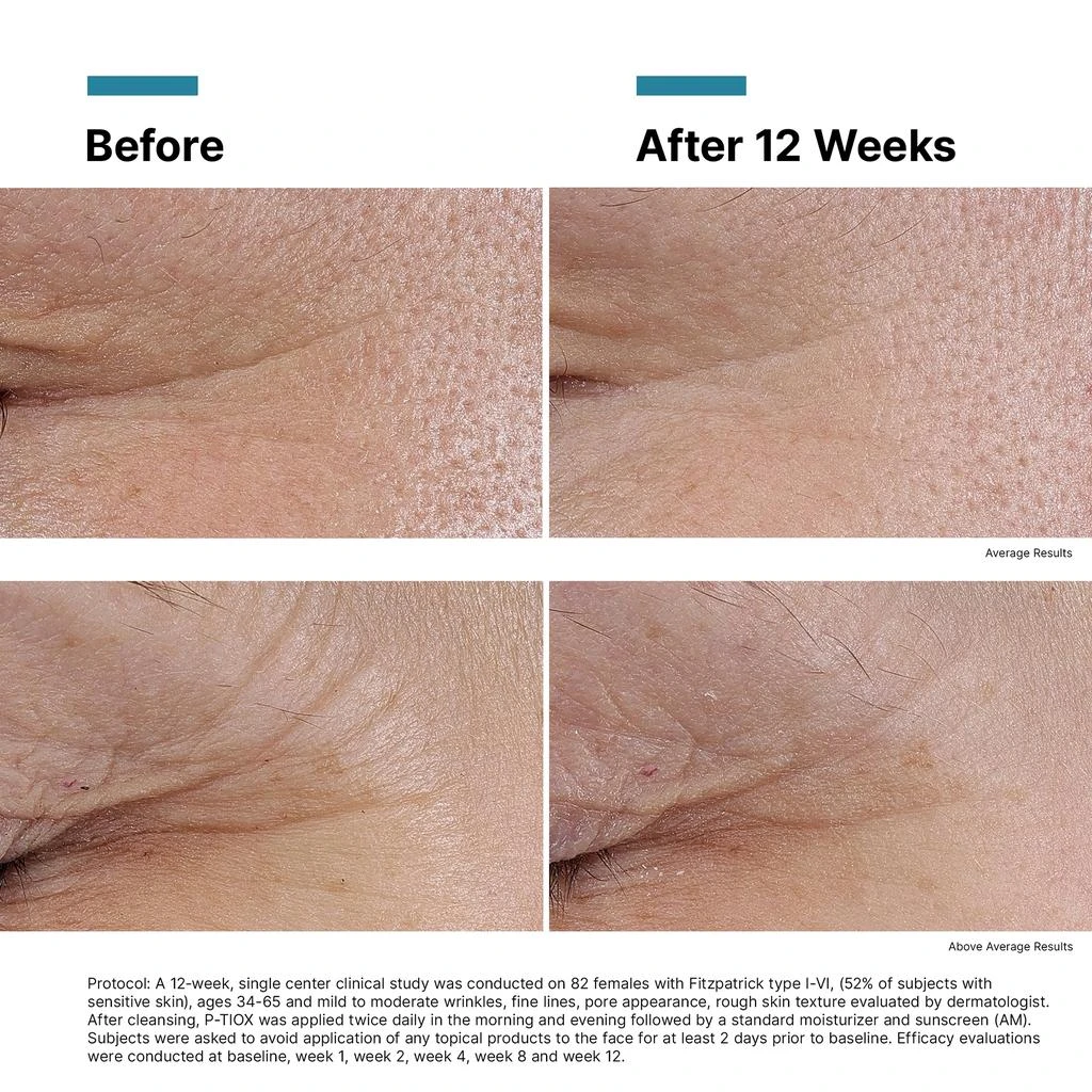 SkinCeuticals SkinCeuticals P-TIOX Anti-Wrinkle Peptide Serum 5