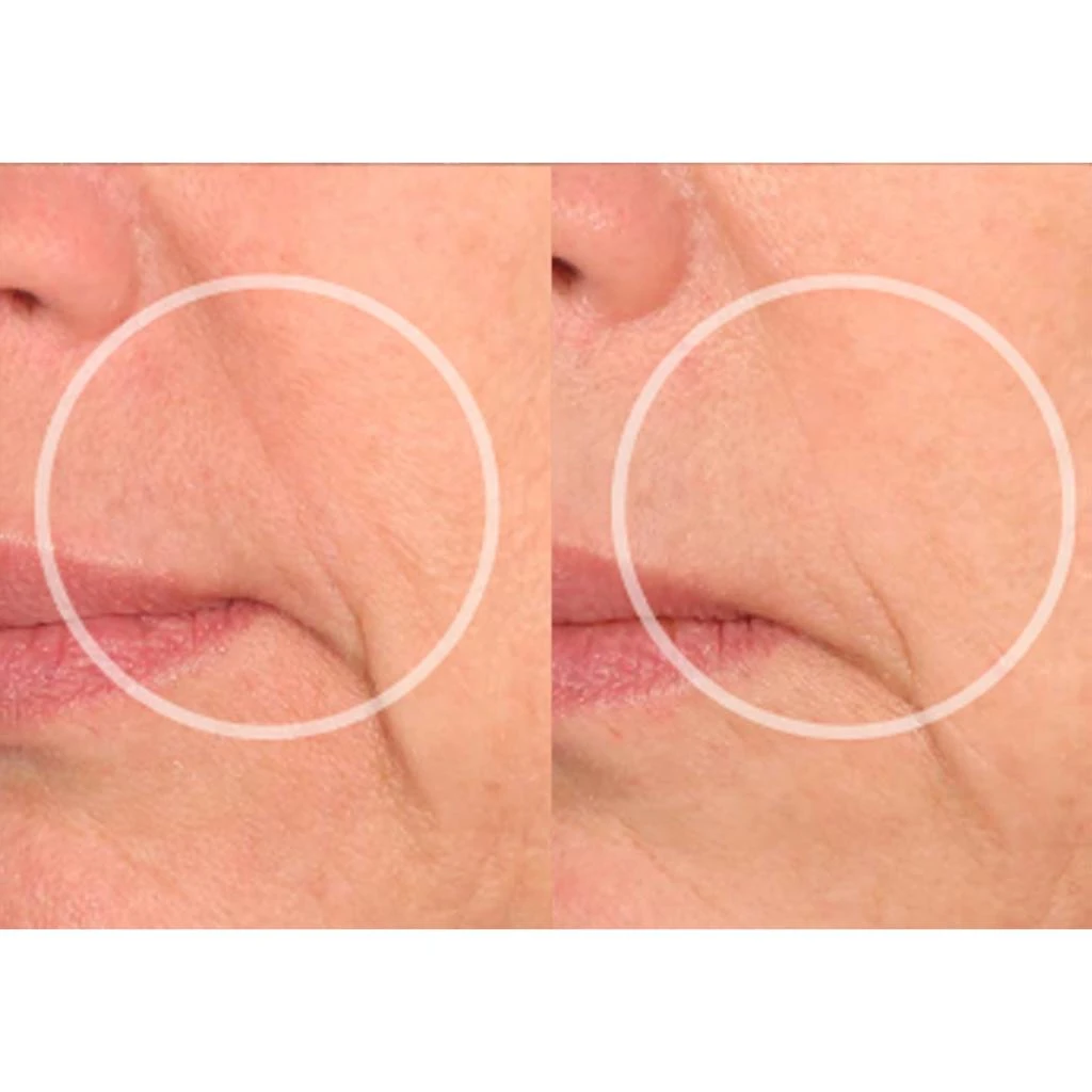 SIO Beauty SiO Beauty SuperLift Pack 7