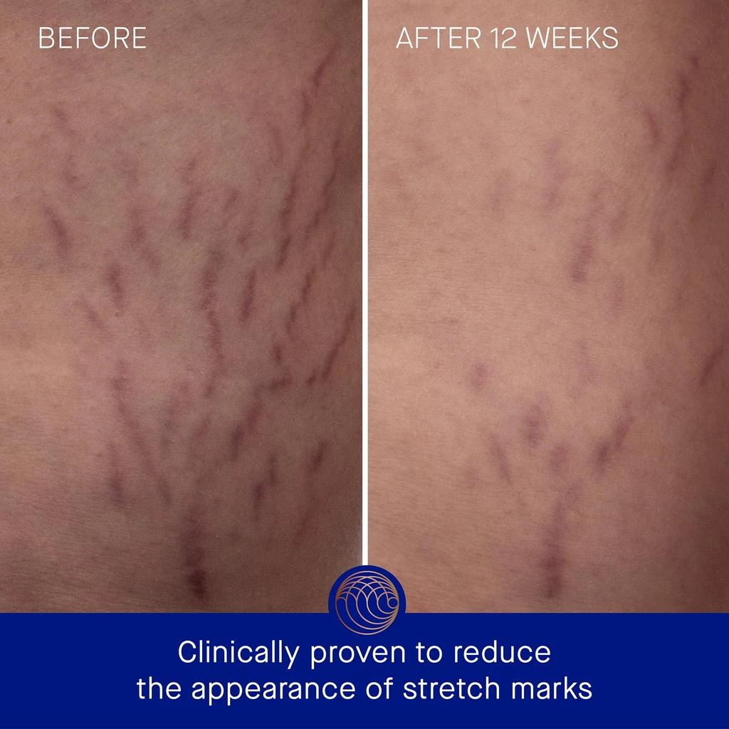 Augustinus Bader Augustinus Bader The Geranium Rose Body Cream 200ml 6