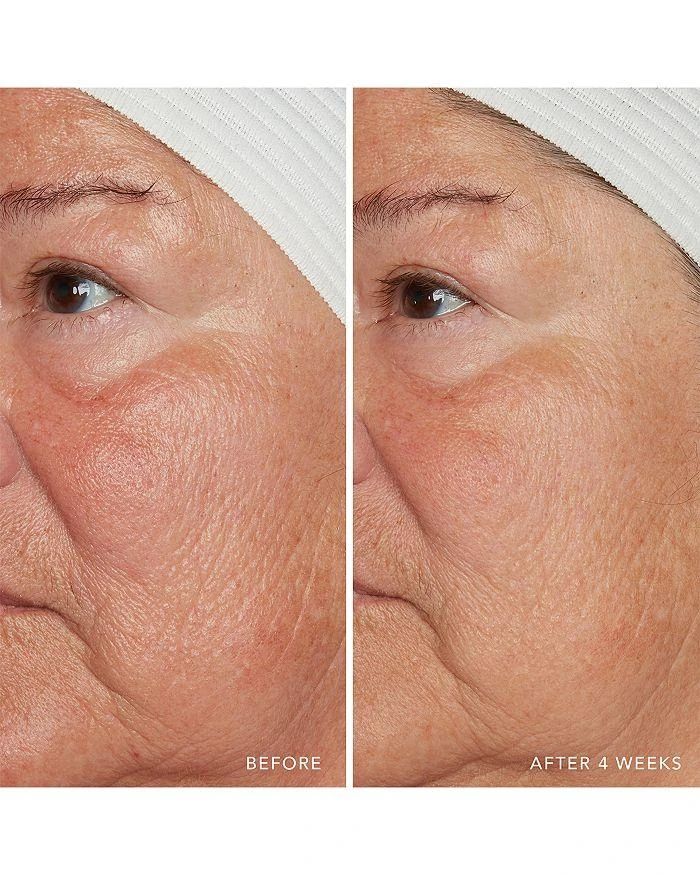 Lancer Redness Relief Intense with Manuka Honey 1.7 oz. 4