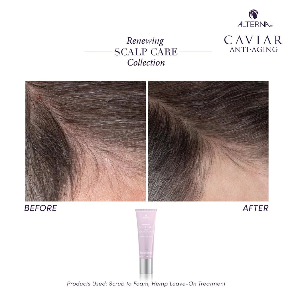 ALTERNA Alterna Renewing Scalp Care Hemp Leave-on Treatment 2.5 oz 4