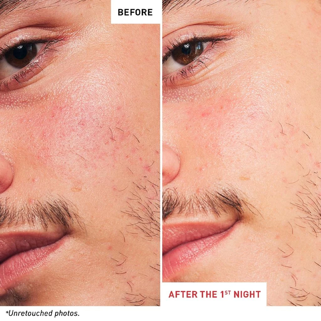 erborian Erborian Skin Therapy Multi-Perfecting Night Oil-Serum 5