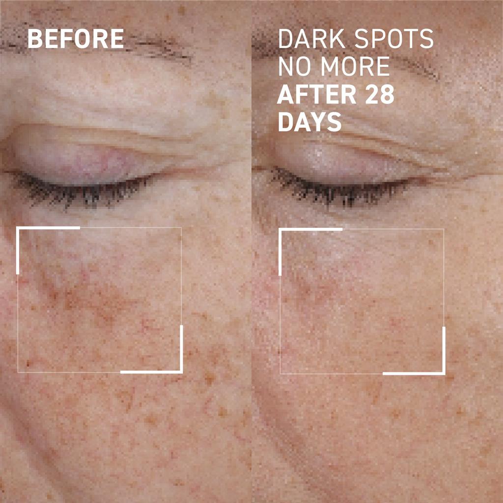 Dr. Brandt Skincare DARK SPOTS NO MORE®