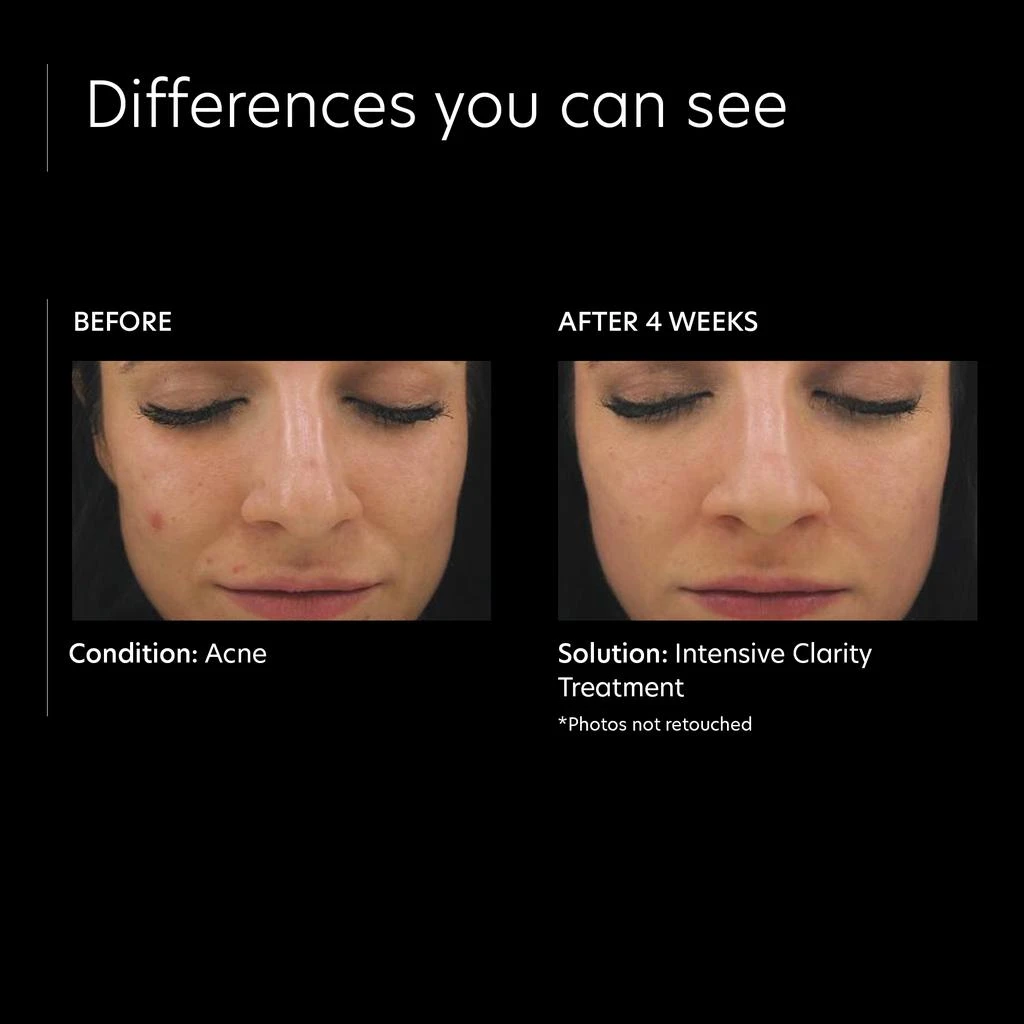 PCA SKIN PCA SKIN Intensive Clarity Treatment 0.5 Pure Retinol Night 4
