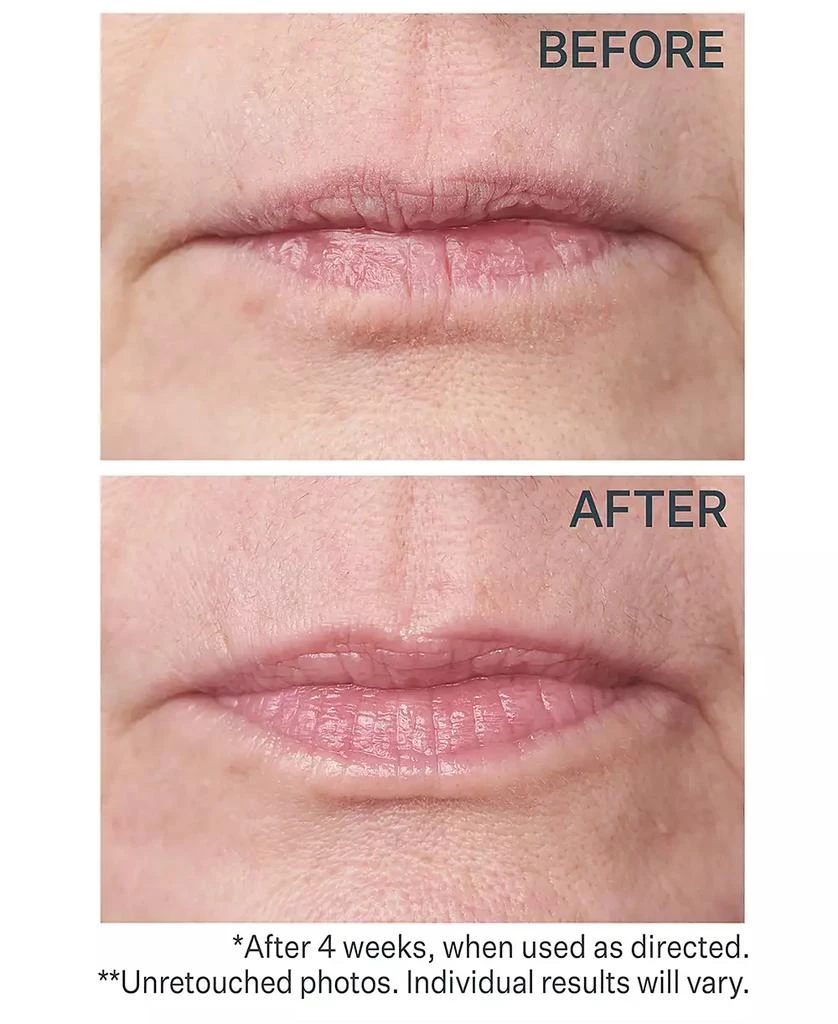 StriVectin Double Fix For Lips Plumping & Vertical Line Treatment, 0.16-oz. 3