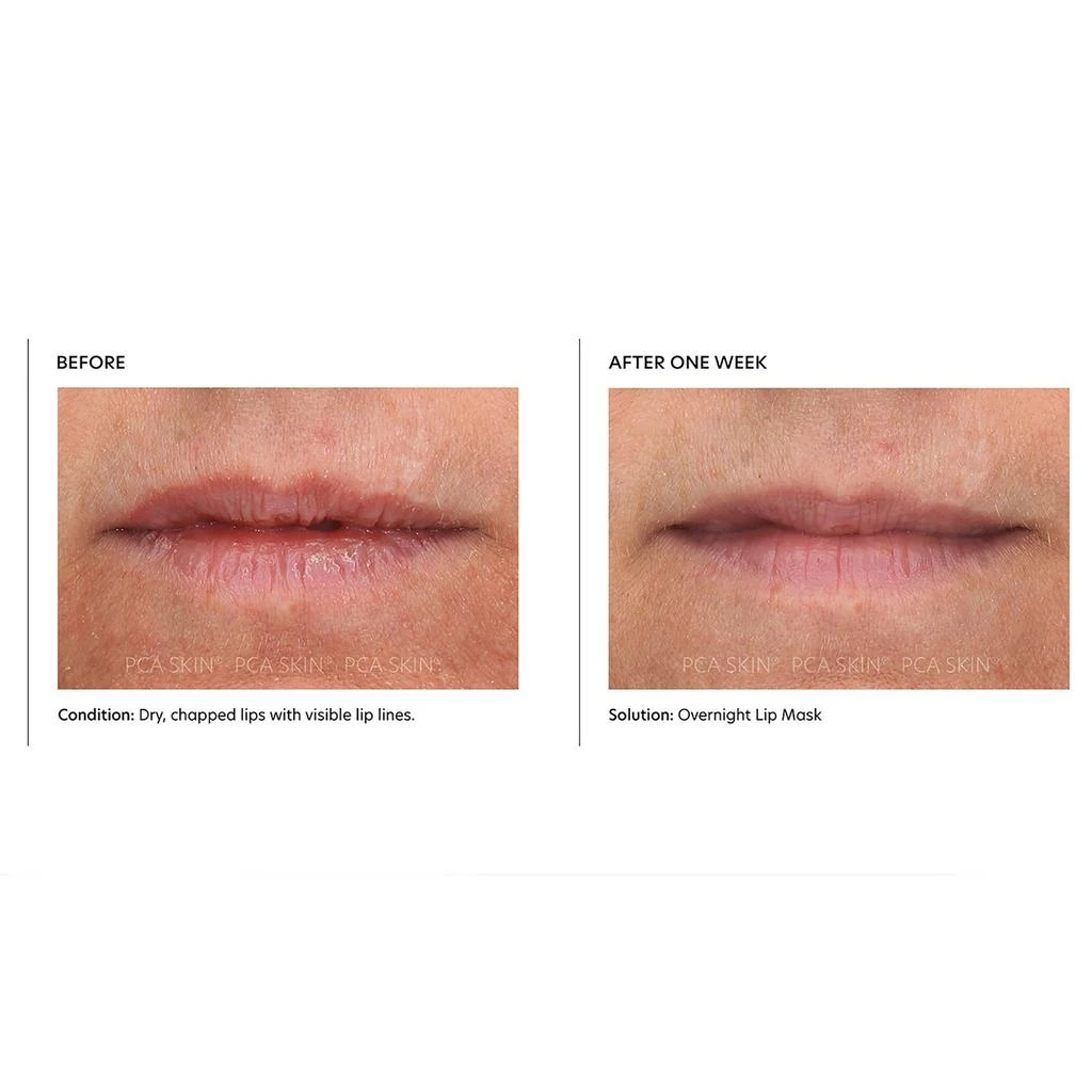 PCA SKIN PCA SKIN Overnight Lip Mask 4