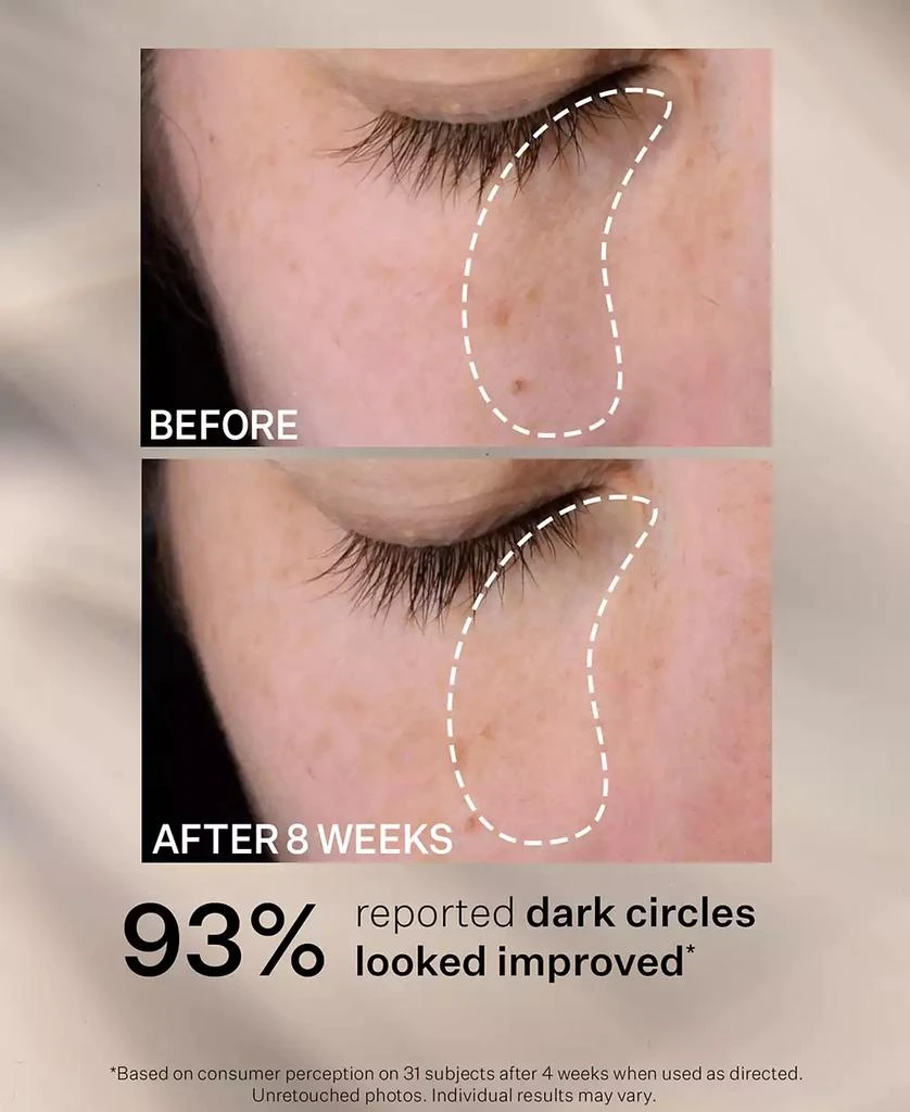 StriVectin Super-C Dark Circle Brightening Eye Serum 6