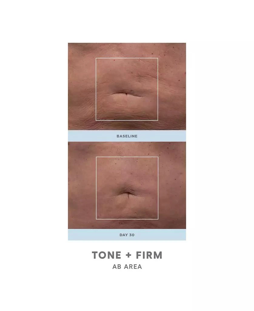 NuFace 2-Pc. NuBODY Skin Toning Device Set 6