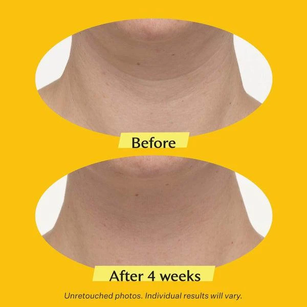 StriVectin StriVectin TL Advanced Tightening Neck Cream PLUS 50ml 2