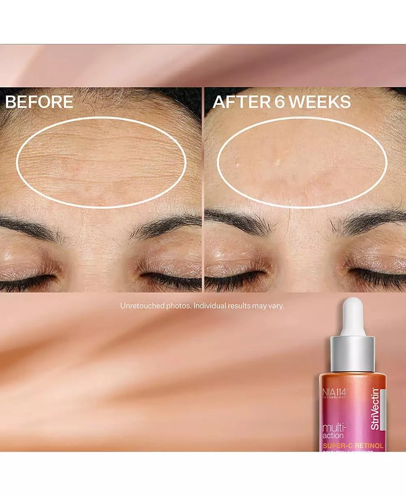 StriVectin Super C Retinol Brighten and Correct Vitamin C Serum, 1oz 8