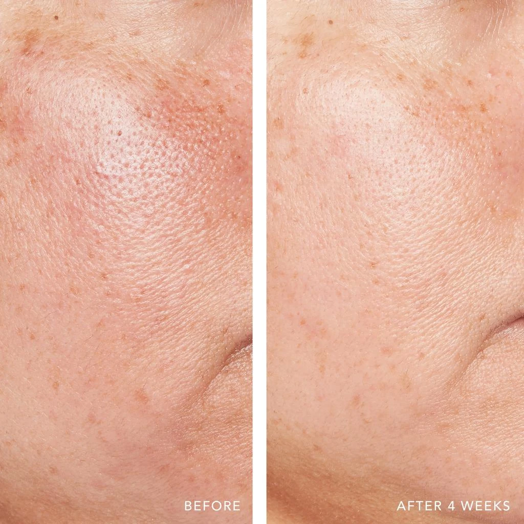 Lancer Skincare Lancer Skincare Advanced Retinol Treatment with 1.25 Retinol 5