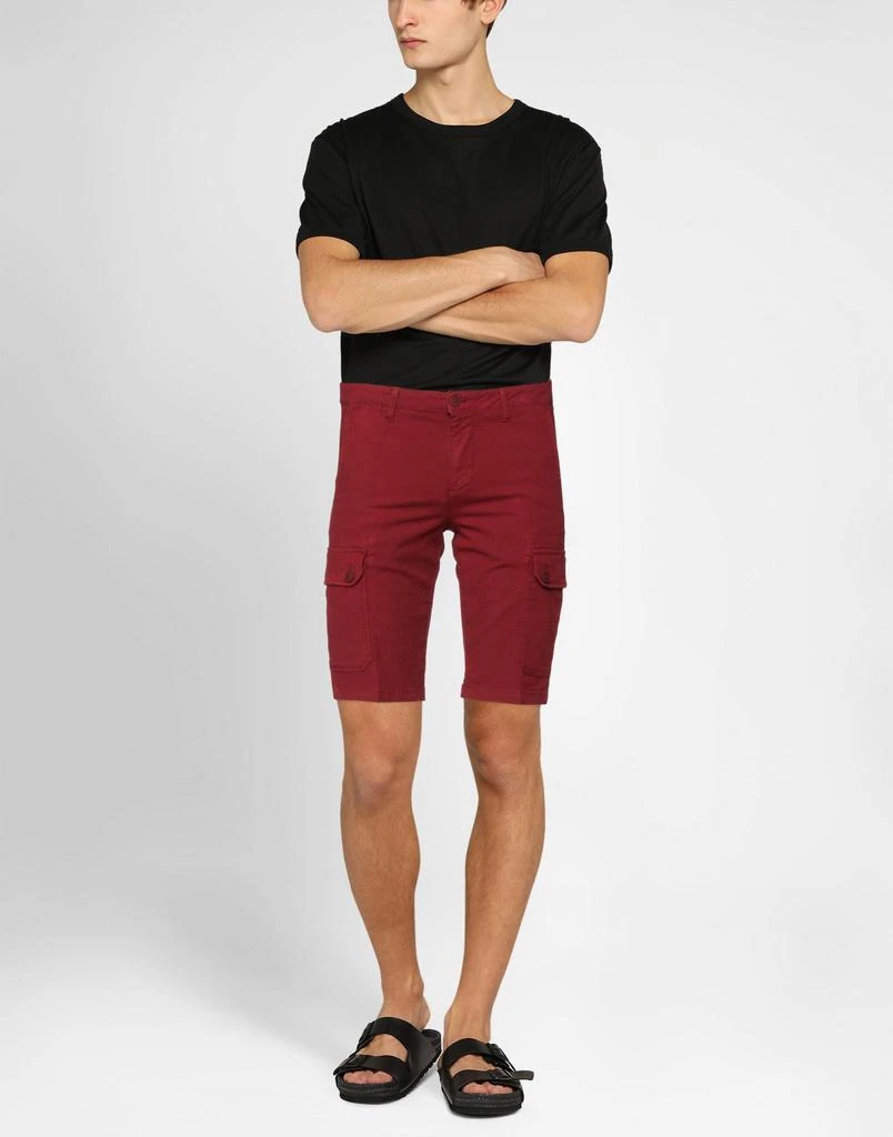 LOST IN ALBION Shorts & Bermuda 2