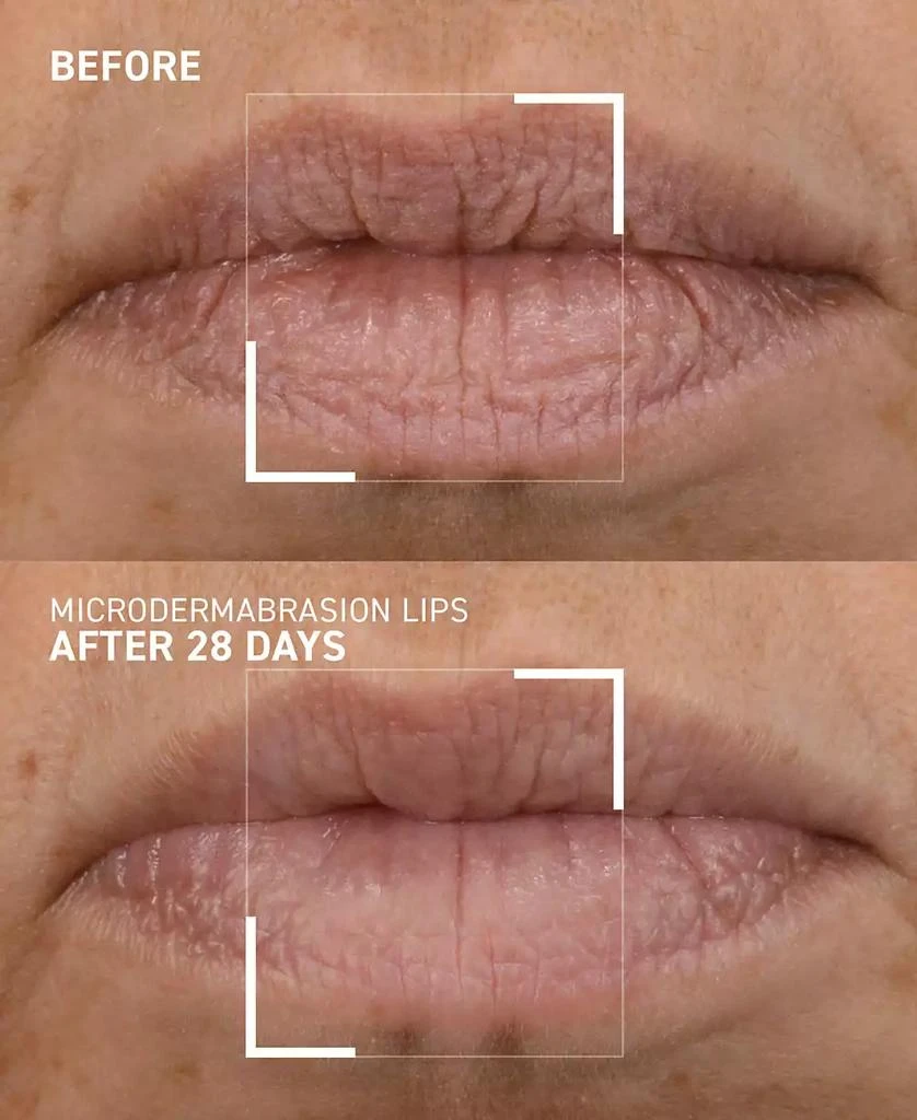 Dr. Brandt Skincare Smoothing Lip Exfoliator, 10 g 2