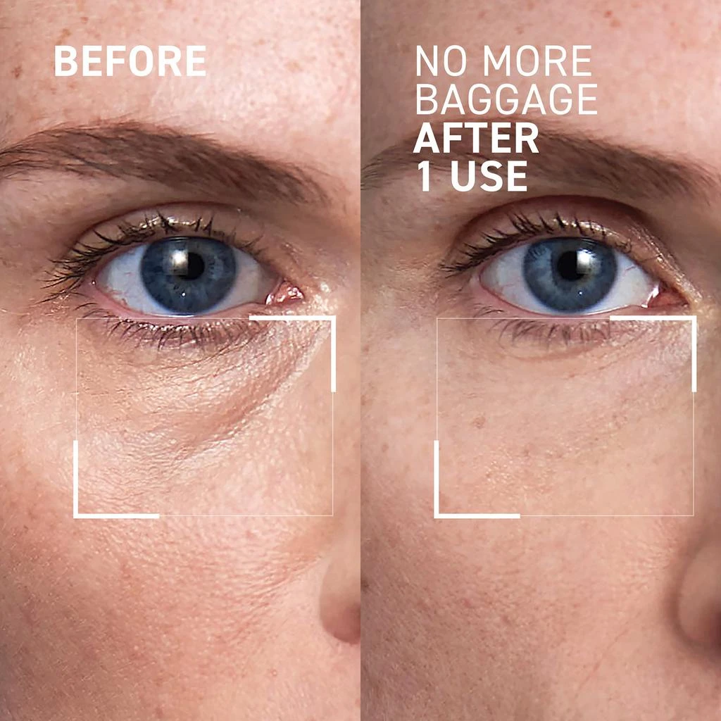 Dr. Brandt Skincare NO MORE BAGGAGE 2