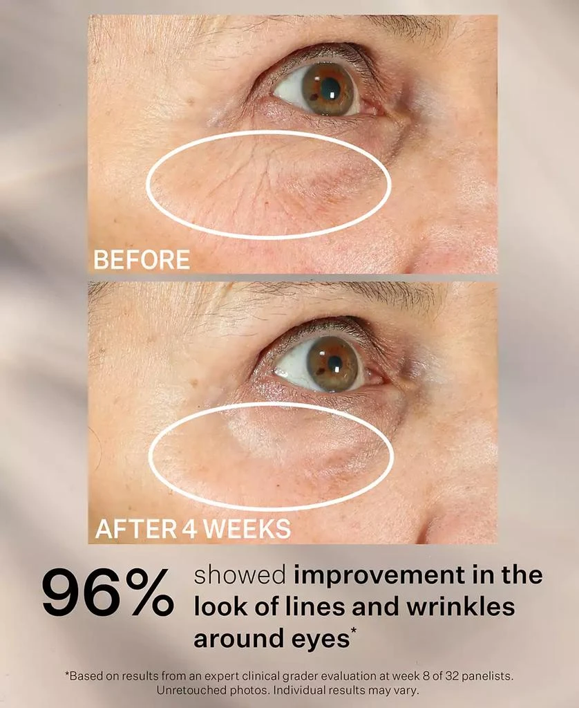 StriVectin Peptight 360 Tightening Eye Serum, 1 oz 7