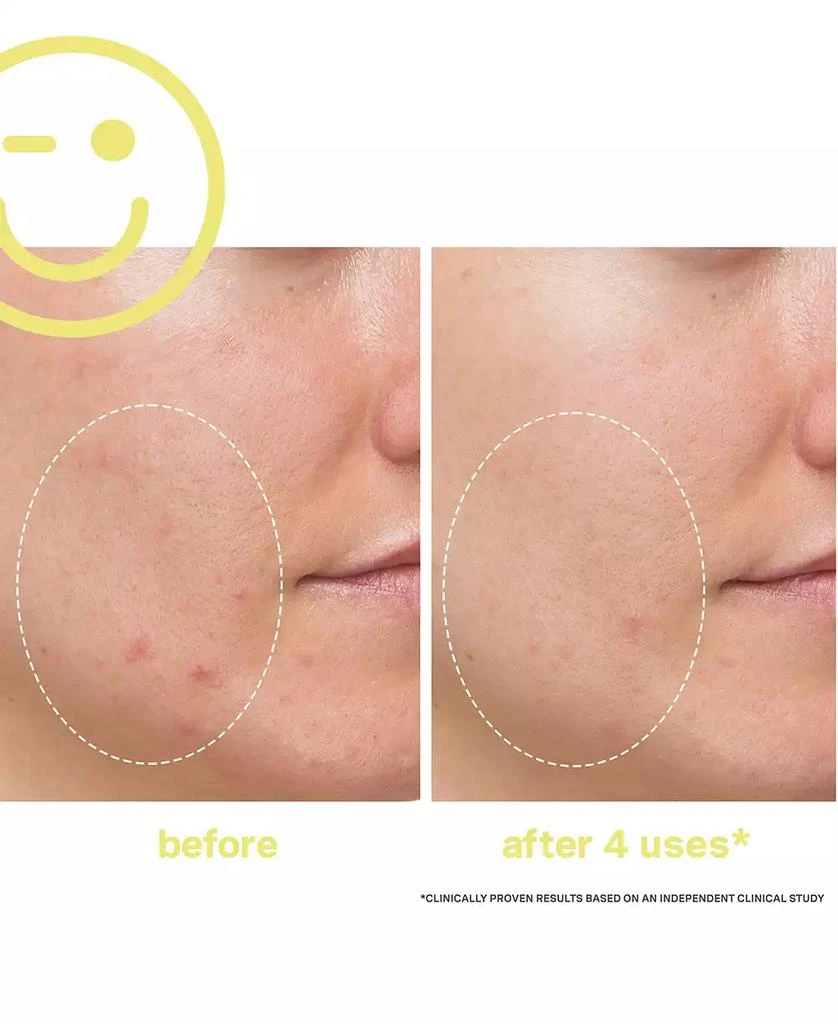 Kate Somerville Mega-C 30% Vitamin C Brightening Facial, 2 oz. 4