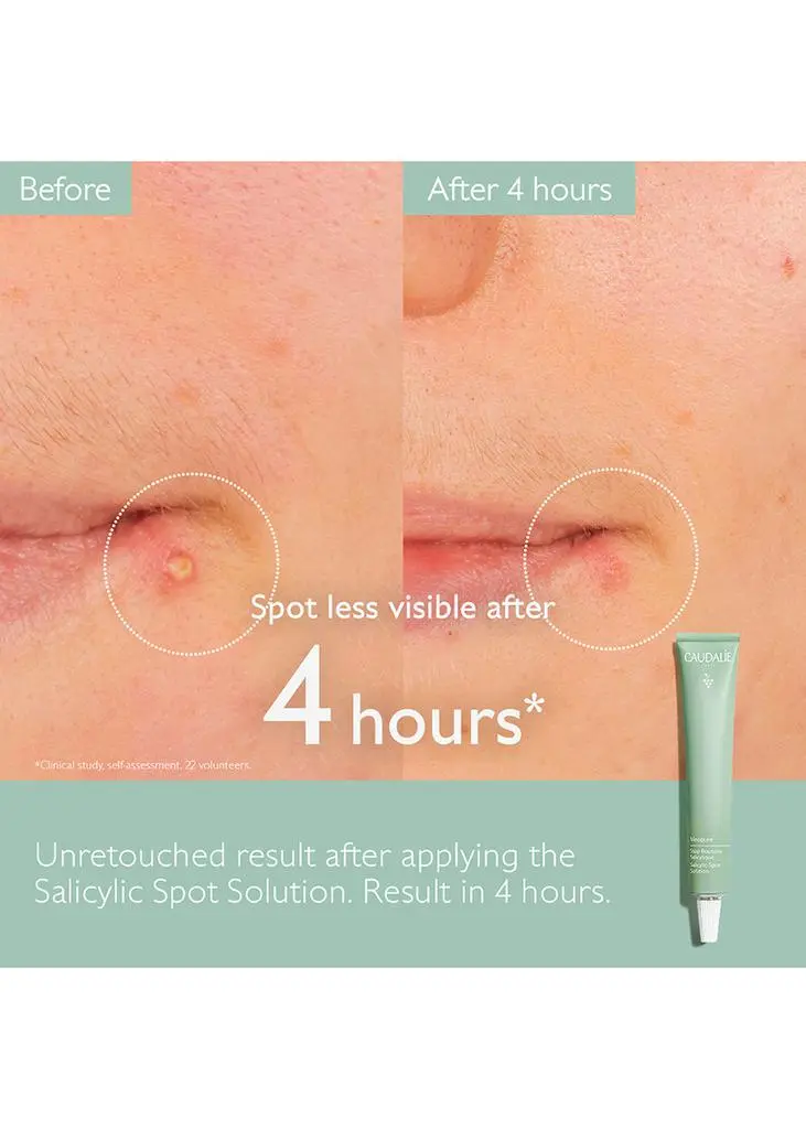 Caudalie Vinopure Salicylic Spot Solution 15ml 2