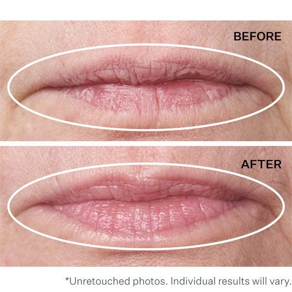 StriVectin StriVectin Double Fix Plumping and Vertical Line Treatment for Lips 10ml 5
