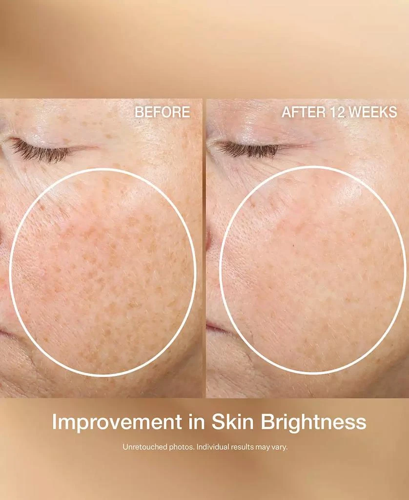 StriVectin Super C Retinol Brighten and Correct Vitamin C Serum, 1oz 4