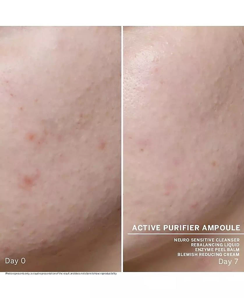 BABOR Active Purifier Ampoule Concentrates 4
