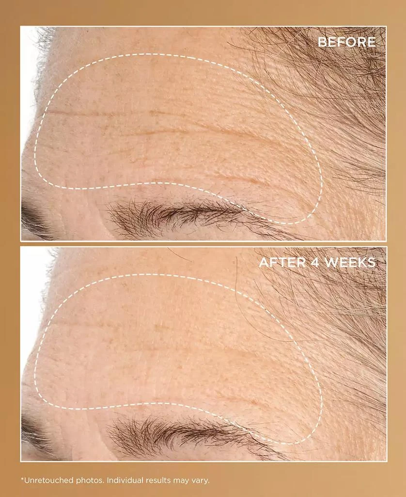 Perricone MD Neuropeptide Deep Crease Serum, 1 oz. 4