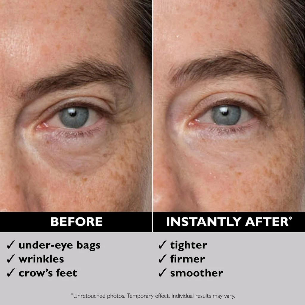 Peter Thomas Roth Instant FIRMx Eye Temporary Eye Tightener | 30 ml / 1.0 fl oz 3